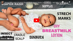 BREAST MILK LOTION | ECZEMA, DIAPER RASH, STRECH MARKS, SORE NIPPLES | DIY